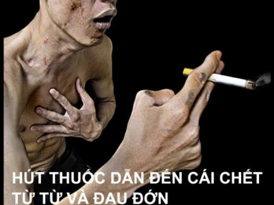 Thuốc lá - thủ phạm gieo rắc ung thư phổi